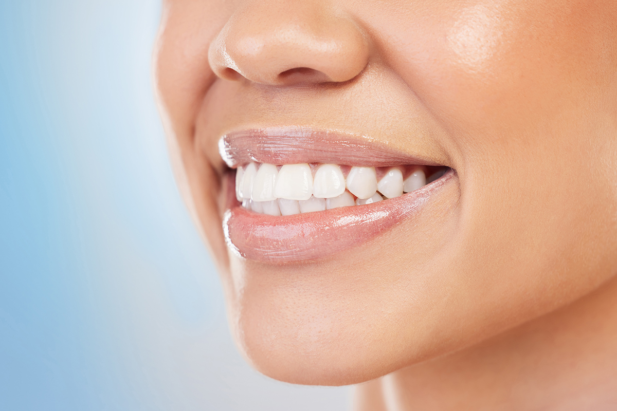 Illuminate Your Smile: The Power of Teeth Whitening